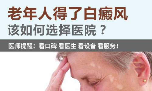 宁波治疗白癜风医院哪里好 老人患白癜风是什么原因呢